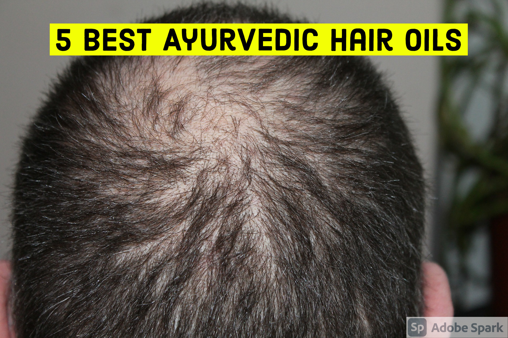 Best Hair Growth Oils in India